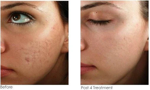 ترمیم کننده سیکاپلاست لاروش پوزای 100 میل